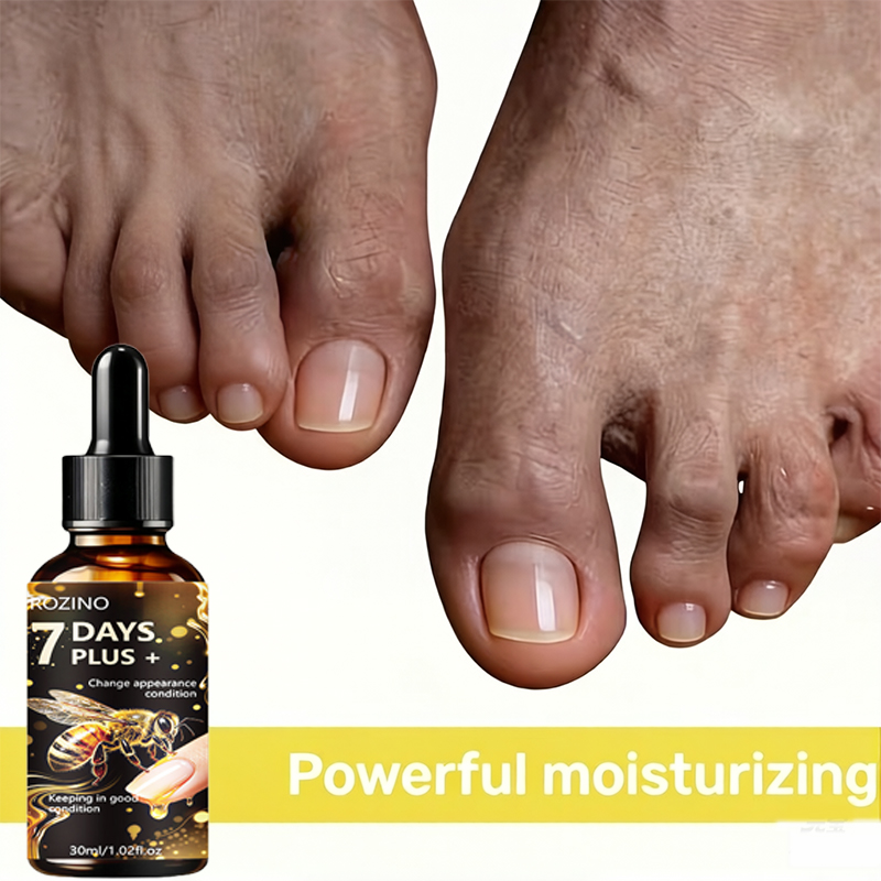 ROZINO nagelserum heeft een he - Skincare Ingredients recensie en prijs